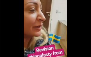 Revision rhinoplasty from sweden