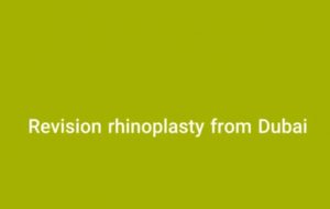 Revision rhinoplasty from Dubai